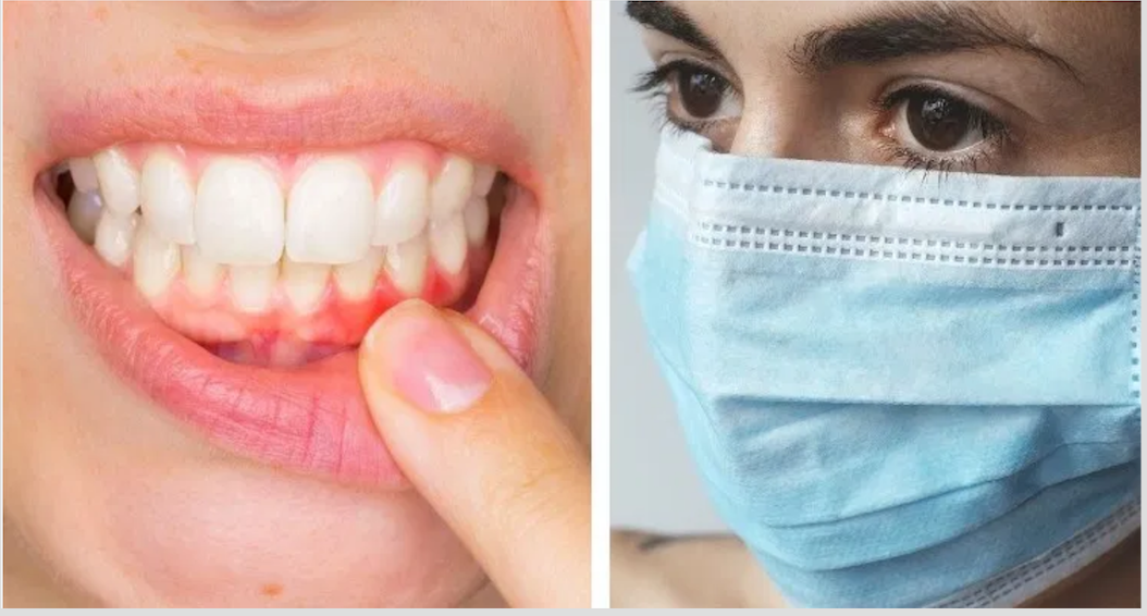 “Mask Mouth” Dentists Warn Gum Disease and Tooth Decay Have Increased
